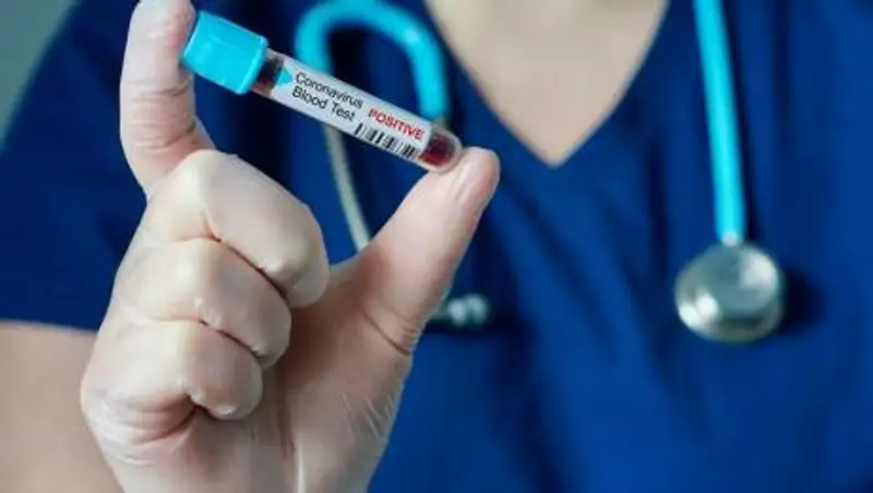 За сутки в Казахстане выявили 64 зараженных COVID-19