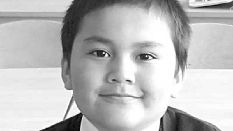 В Костанае собака откусила 8-летнему мальчику нос