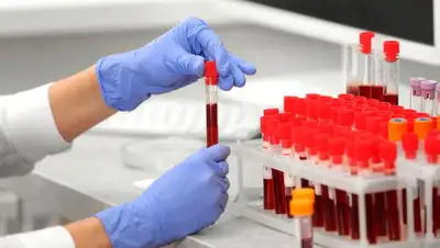 inform.kz, фото - Новости Zakon.kz от 02.07.2020 14:02