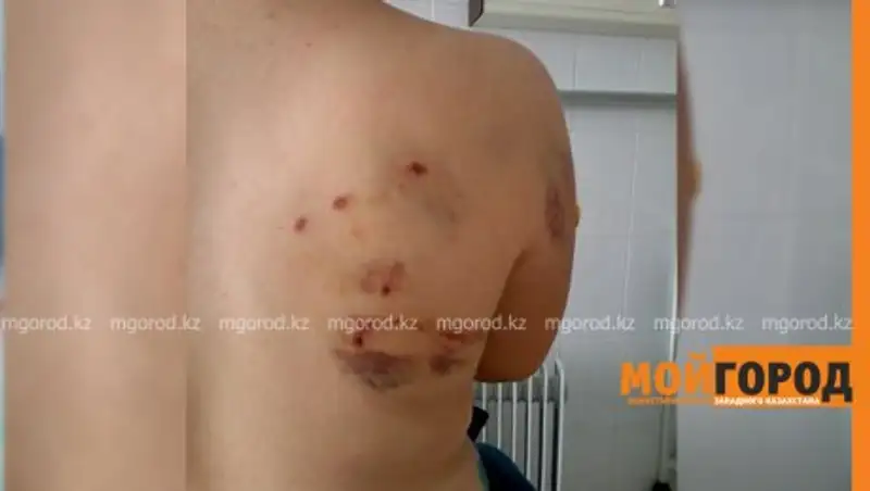 Бездомная собака искусала девочку в Уральске