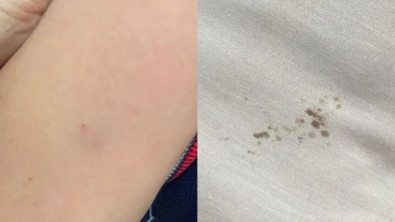 В Шымкенте учитель проткнула ручкой руку пятиклассника