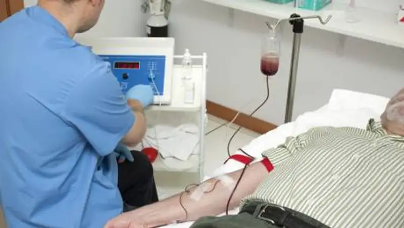 Язвы на слизистой рта: Онкологи назвали симптомы рака головы и шеи