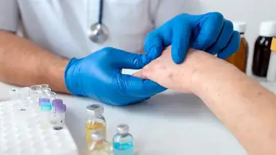 Вспышка кори в Казахстане: с чем связан рост заболеваемости и когда он пойдет на спад, фото - Новости Zakon.kz от 14.11.2023 18:02