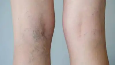 zdorovieinfo, фото - Новости Zakon.kz от 16.03.2021 08:48