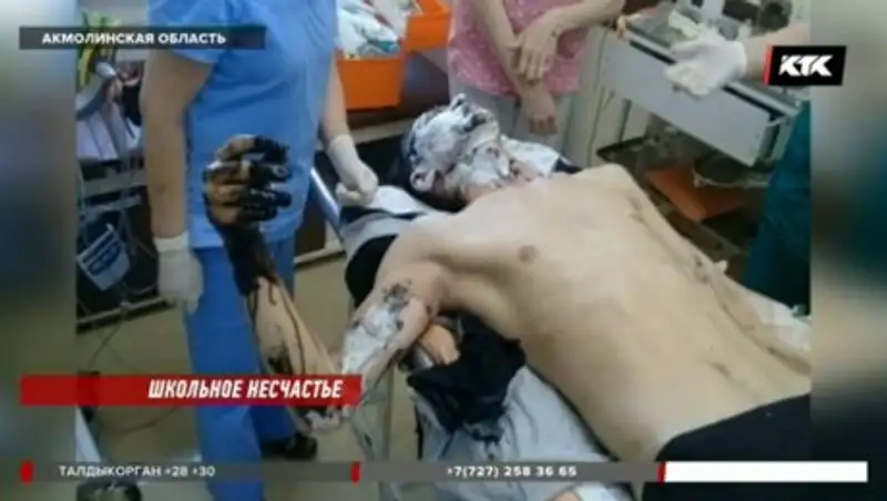 Акмолинский учитель, спасая детей, вылил ведро гудрона на себя