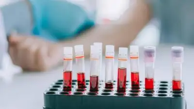 pixabay.com, фото - Новости Zakon.kz от 04.03.2021 09:43