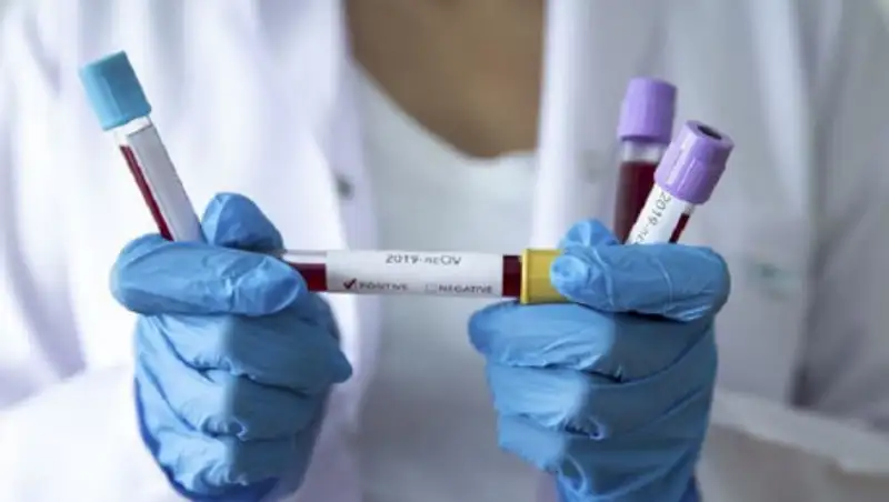 В Казахстане зарегистрированы 86 новых случаев COVID-19