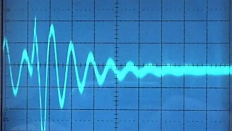 В Кокшетау в роддоме после кесарева сечения скончалась 24-летняя женщина
