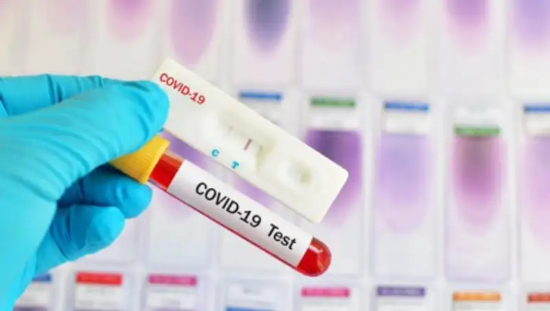 Тест-системы на 1,2 млн исследований планируют закупить в Казахстане