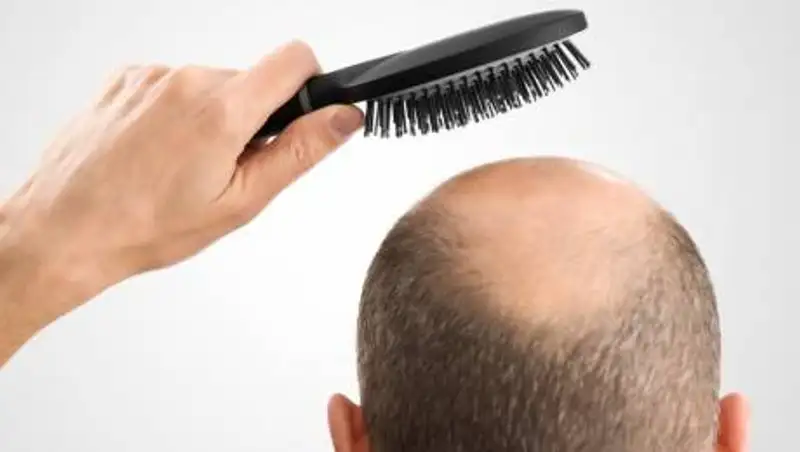 Выпадение волос может быть связано с наличием половой инфекции