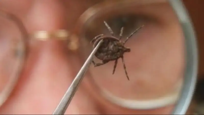 В Восточном Казахстане зафиксировали случай клещевого энцефалита