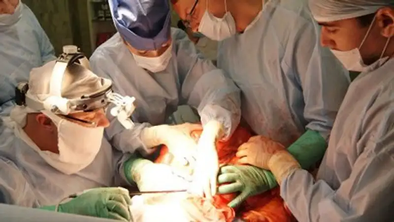 Россиянину удалили опухоль весом 37 килограммов