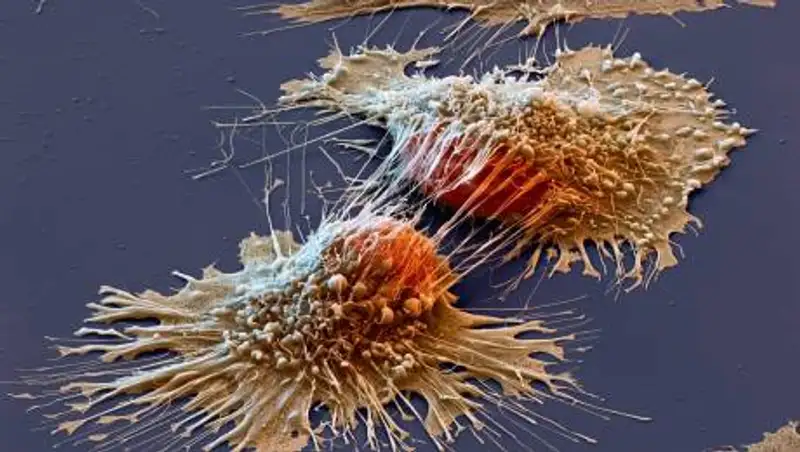 Врач назвал два продукта, которые увеличивают риск возникновения рака