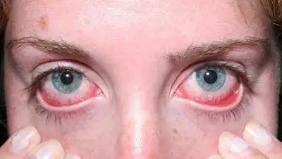 из открытых источников, фото - Новости Zakon.kz от 07.02.2019 11:15