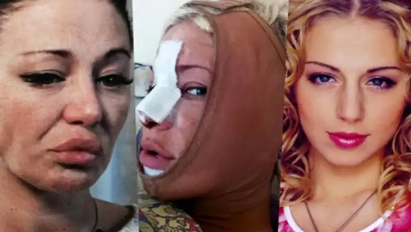 Саша Project отсудила у пластических хирургов 90 тысяч