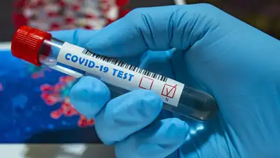 Опубликована суточная статистика по Covid-19 в Казахстане , фото - Новости Zakon.kz от 11.04.2023 09:31