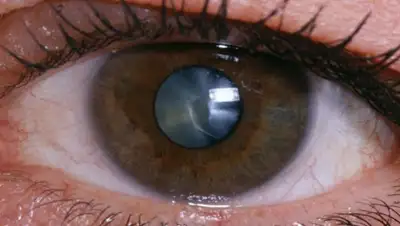 oftalmika.ru, фото - Новости Zakon.kz от 08.05.2019 09:00