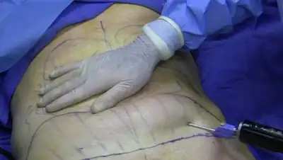 Michael S. Schwartz, M.D. (Terms of Use), фото - Новости Zakon.kz от 20.01.2021 10:09