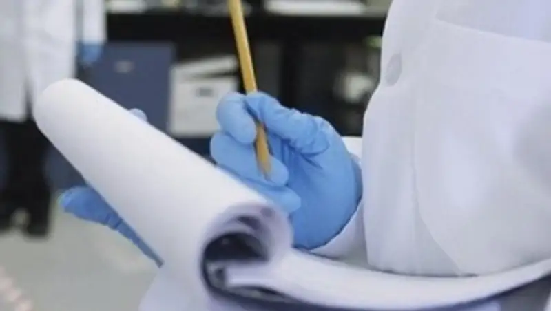 Подожженный мальчик из Тараза чувствует себя лучше