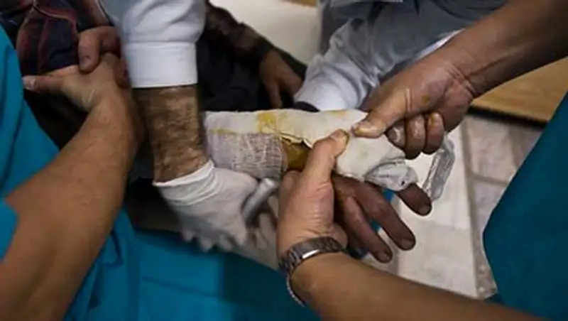 В Актау за последние дни в больницу с различными травмами попало более двадцати человек, фото - Новости Zakon.kz от 06.11.2013 21:52