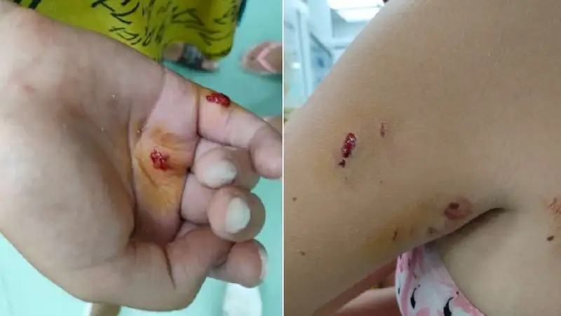 Двух девочек покусал тюлень в Актау