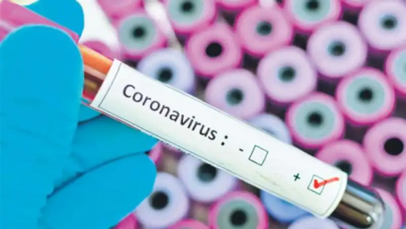 Число новых случаев COVID-19 в Казахстане снизилось