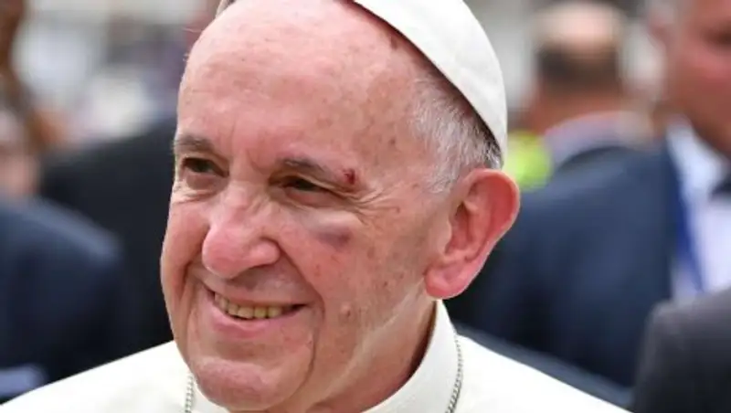 Папа Римский пострадал при резком торможении папамобиля в Колумбии