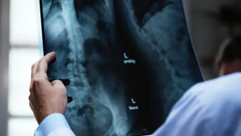 О состоянии пострадавших в массовом ДТП в Алматы рассказали медики