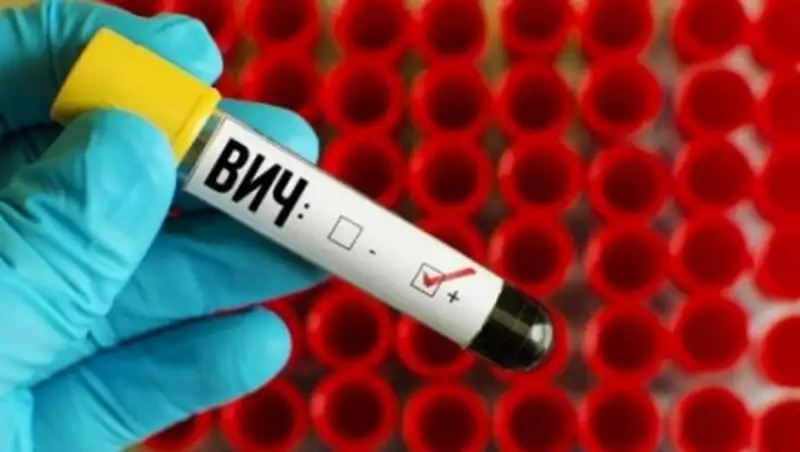 В Темиртау мужчина заразил четырех женщин ВИЧ