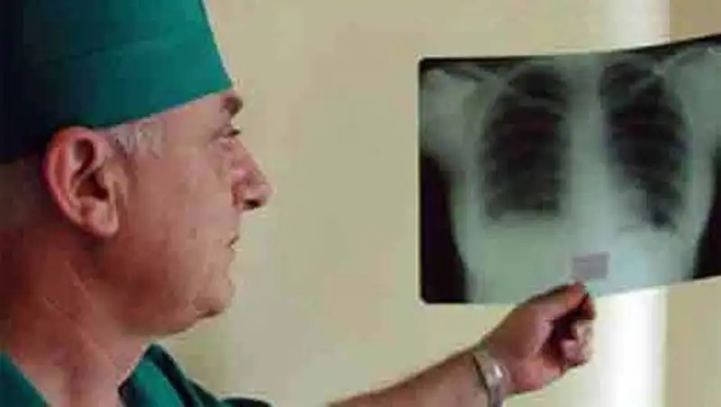 По улицам Усть-Каменогорска разгуливают больные туберкулезом