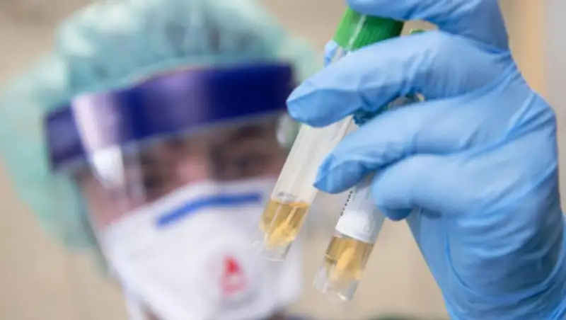 Заболевшая коронавирусом модель рассказала о странном звуке из легких