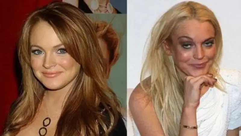 Знаменитости, которых возраст бесповоротно испортил