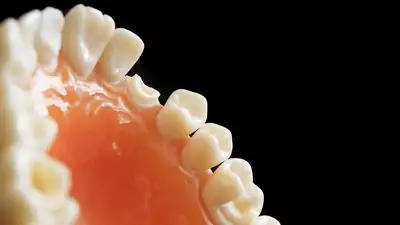 Врачи нашли еще одного виновника ожирения, фото - Новости Zakon.kz от 29.07.2023 06:00