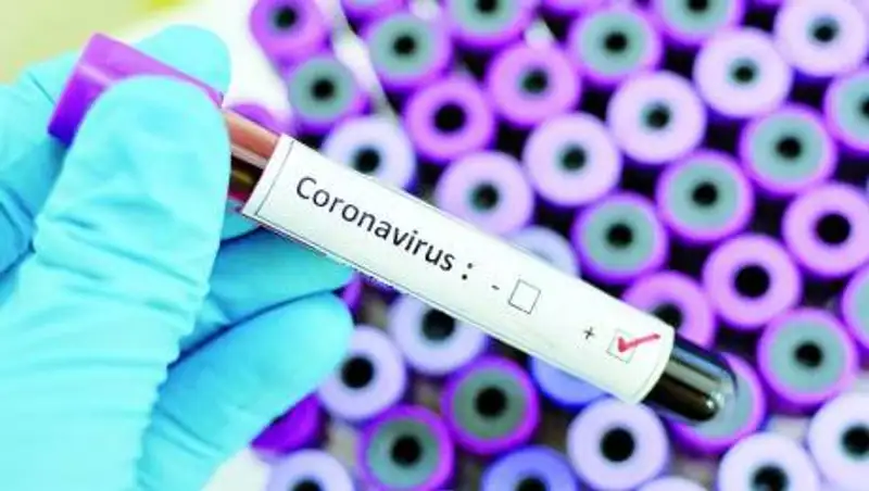 Сколько казахстанцев скончались от коронавируса и пневмонии за сутки