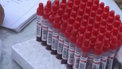 бруцеллез , фото - Новости Zakon.kz от 27.06.2023 22:46