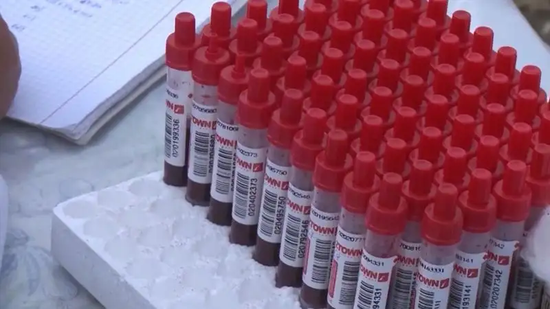 В Костанайской области 18 человек заразились бруцеллезом