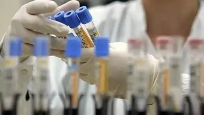 Pixabay, фото - Новости Zakon.kz от 23.08.2020 01:20