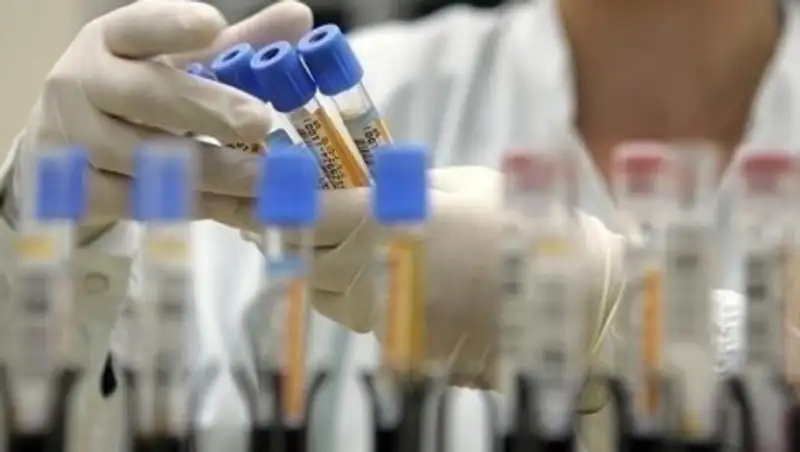 Более 23 млн человек в мире заразились COVID-19