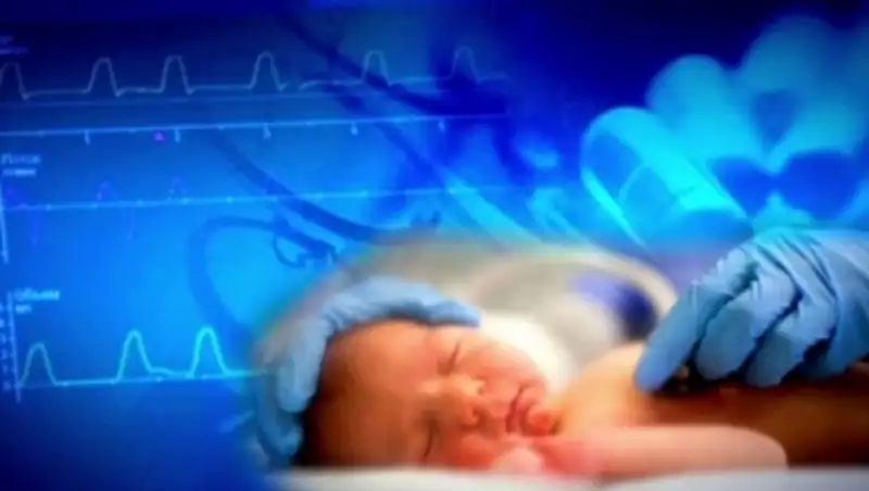 В Таразе врачи спасают жизни младенцам с редкими патологиями 