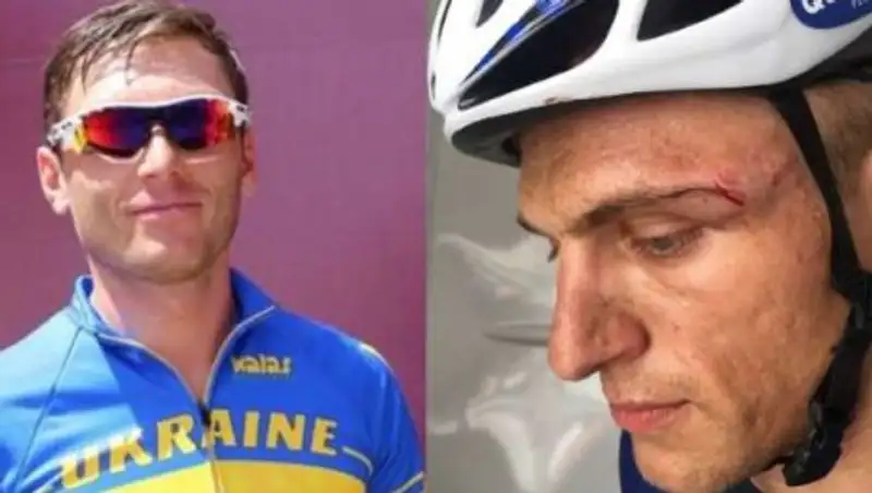 Велогонщик "Астана" был исключен из многодневки за то, что разбил лицо лидеру гонки