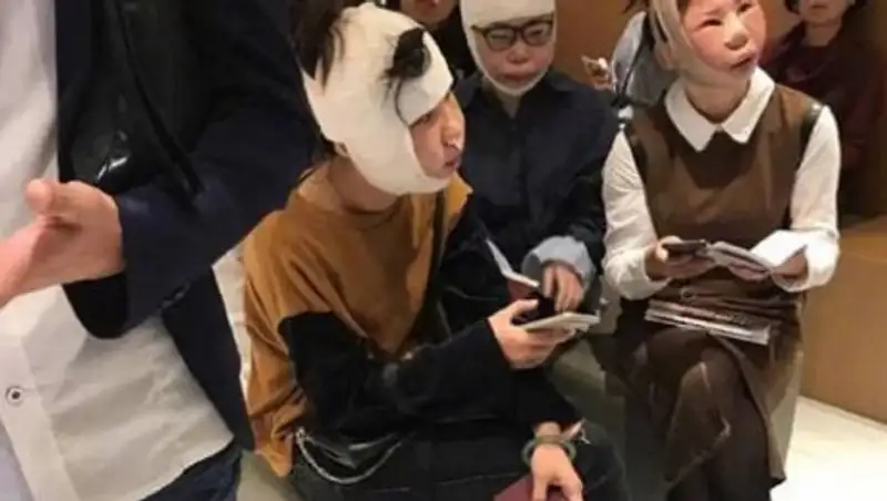 Китаянки застряли в аэропорту, не сумев пройти паспортный контроль после пластики