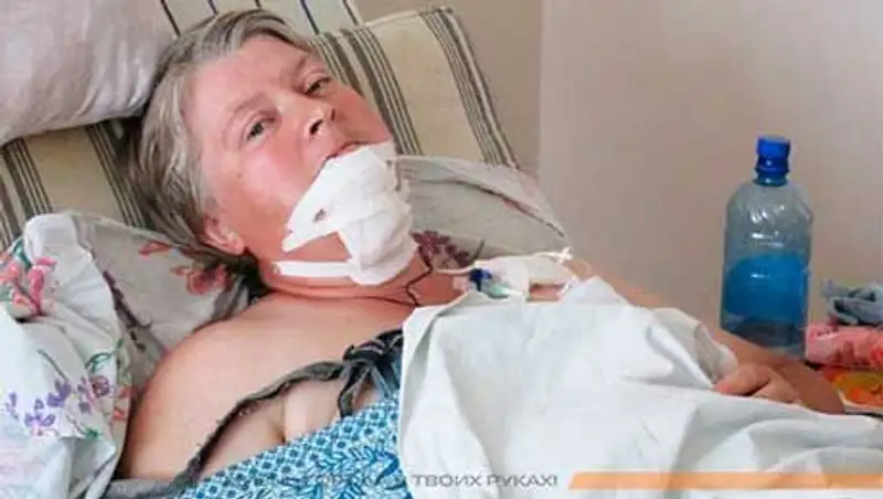 Жительница Рудного пострадала в автомобильной аварии, ожидая автобуса на дачной остановке