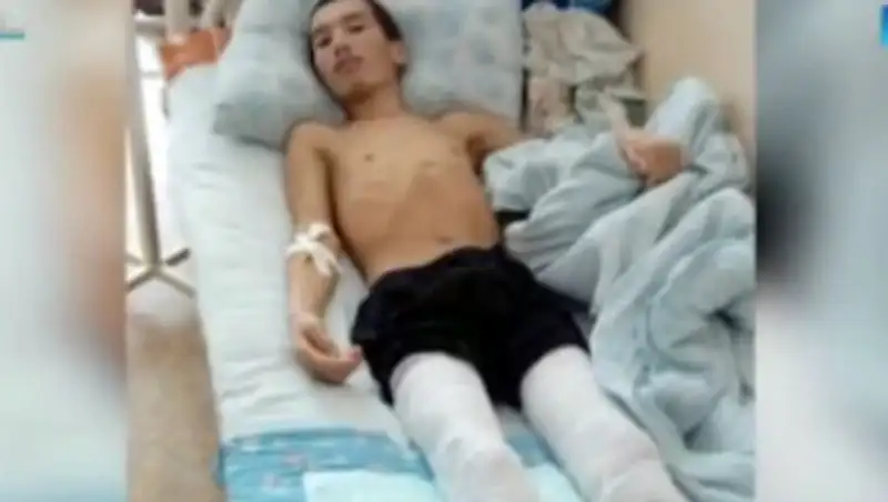 Д&#1241;рігерлер &#1179;&#1201;лды&#1179;тан орал&#1171;ан жігітті&#1187; ая&#1171;ын кесуге м&#1241;жб&#1199;р болды