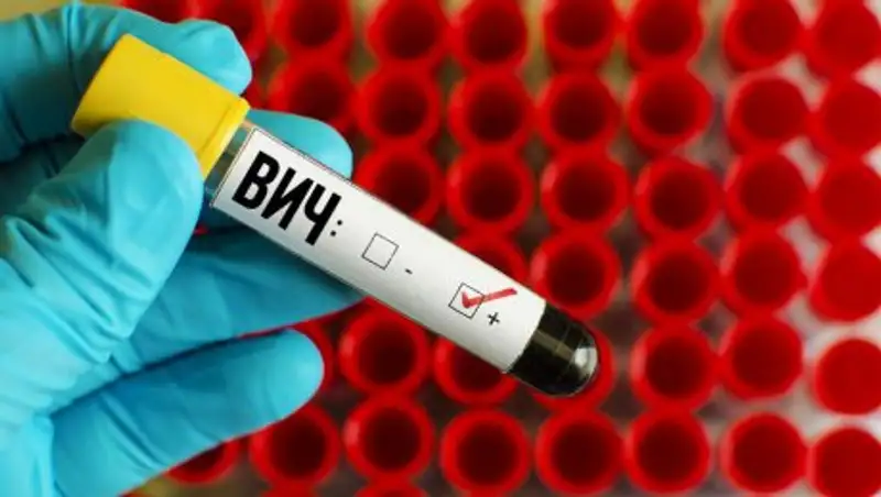 СПИД не спит: сколько людей с ВИЧ в Алматы
