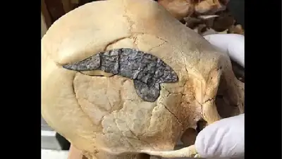 Древние хирурги, Перу, фото - Новости Zakon.kz от 19.01.2022 00:57