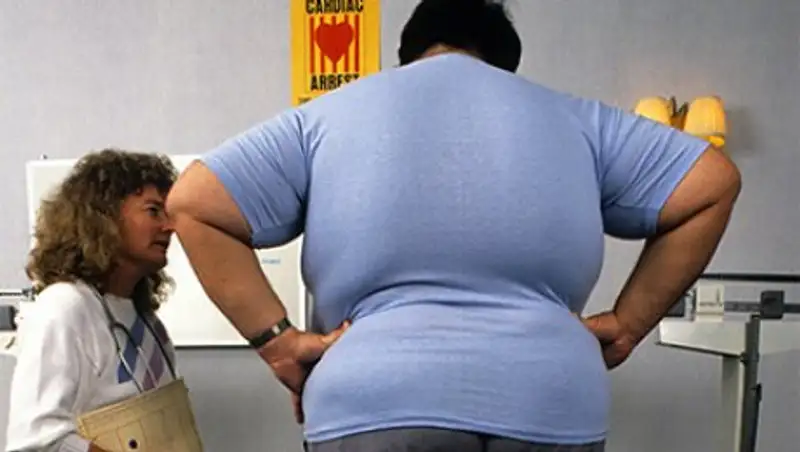 Названа неустранимая опасность лишнего веса