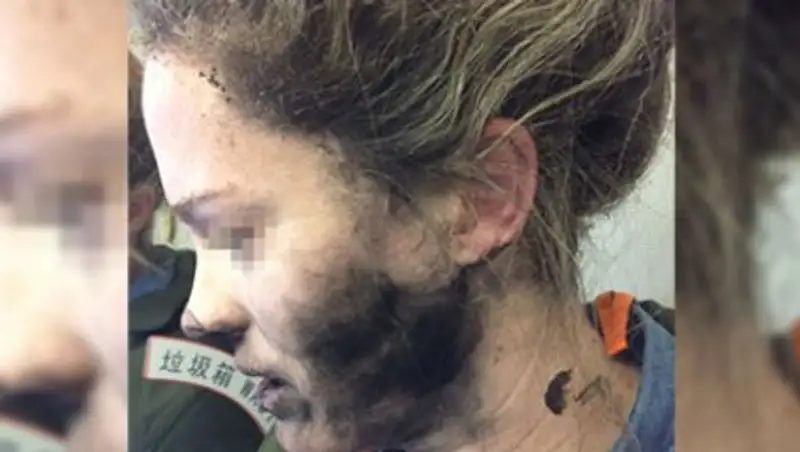 В Австралии у пассажирки во время авиарейса взорвались наушники