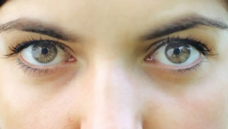 Названы причины остекленения глаза