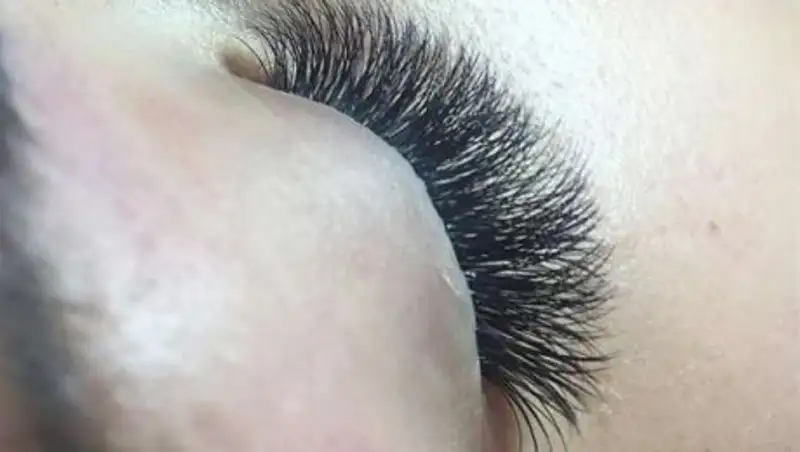 Что делать, если после наращивания ресниц слезятся глаза