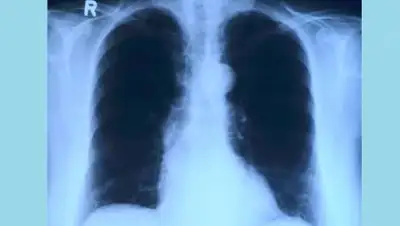 pixabay.com, фото - Новости Zakon.kz от 25.03.2021 16:28